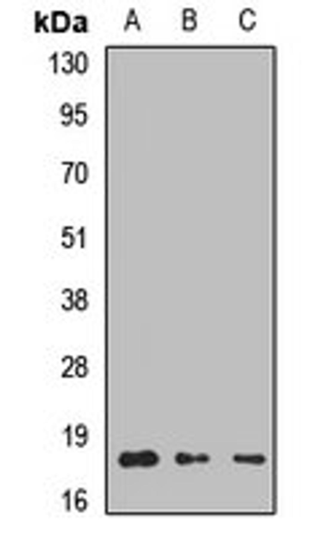 Western blot analysis of Hela (Lane1), Jurkat (Lane2), mouse brain (Lane3) whole cell lysates using LAMTOR1 antibody