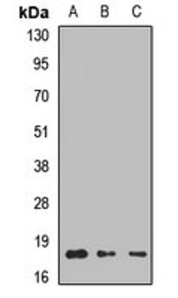 Western blot analysis of Hela (Lane1), Jurkat (Lane2), mouse brain (Lane3) whole cell lysates using LAMTOR1 antibody