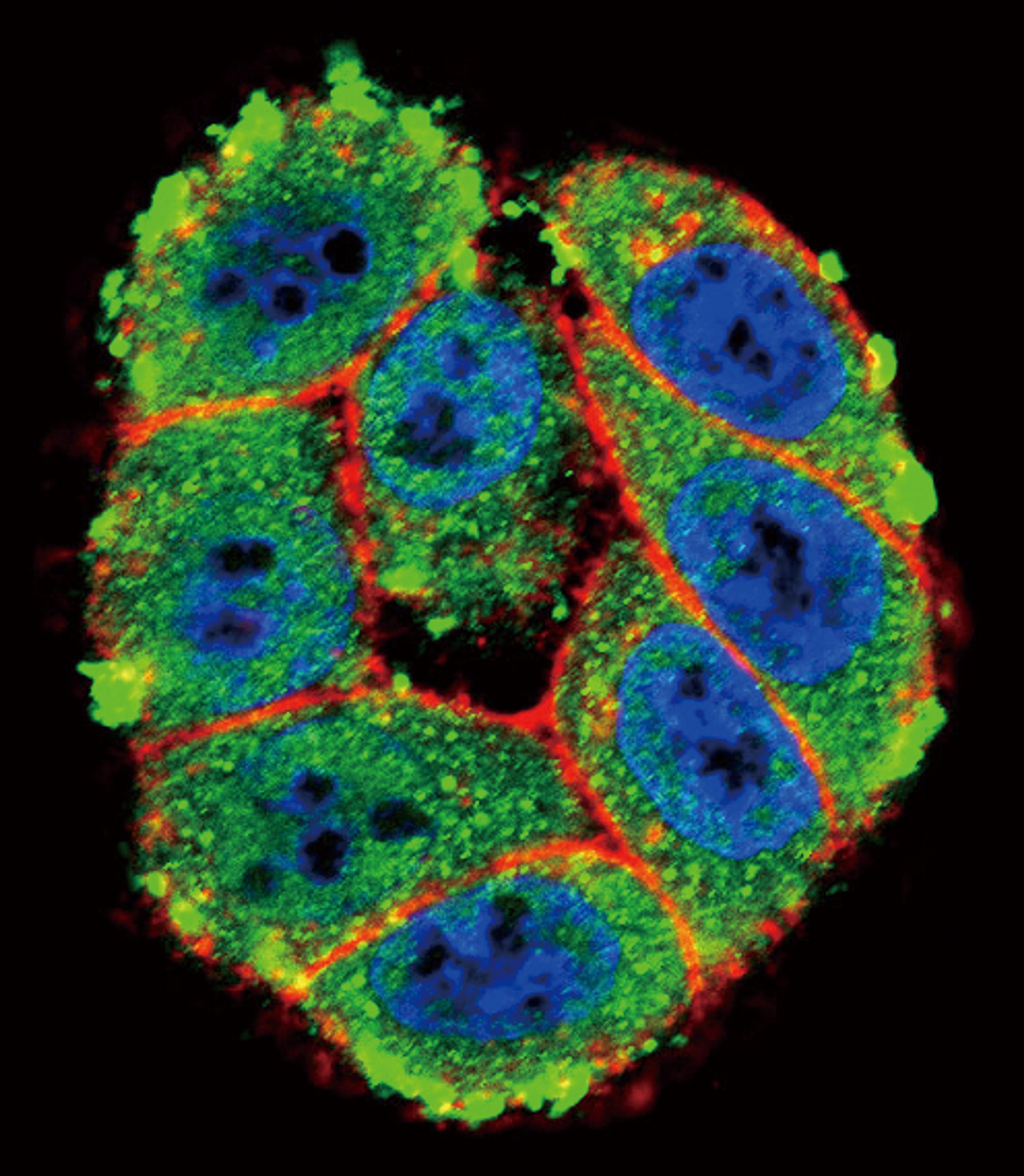 Confocal immunofluorescent analysis of PKC alpha Antibody with Hela cell followed by Alexa Fluor 488-conjugated goat anti-rabbit lgG (green). Actin filaments have been labeled with Alexa Fluor 555 phalloidin (red).DAPI was used to stain the cell nuclear (