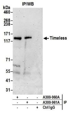 Detection of human Timeless by western blot of immunoprecipitates.