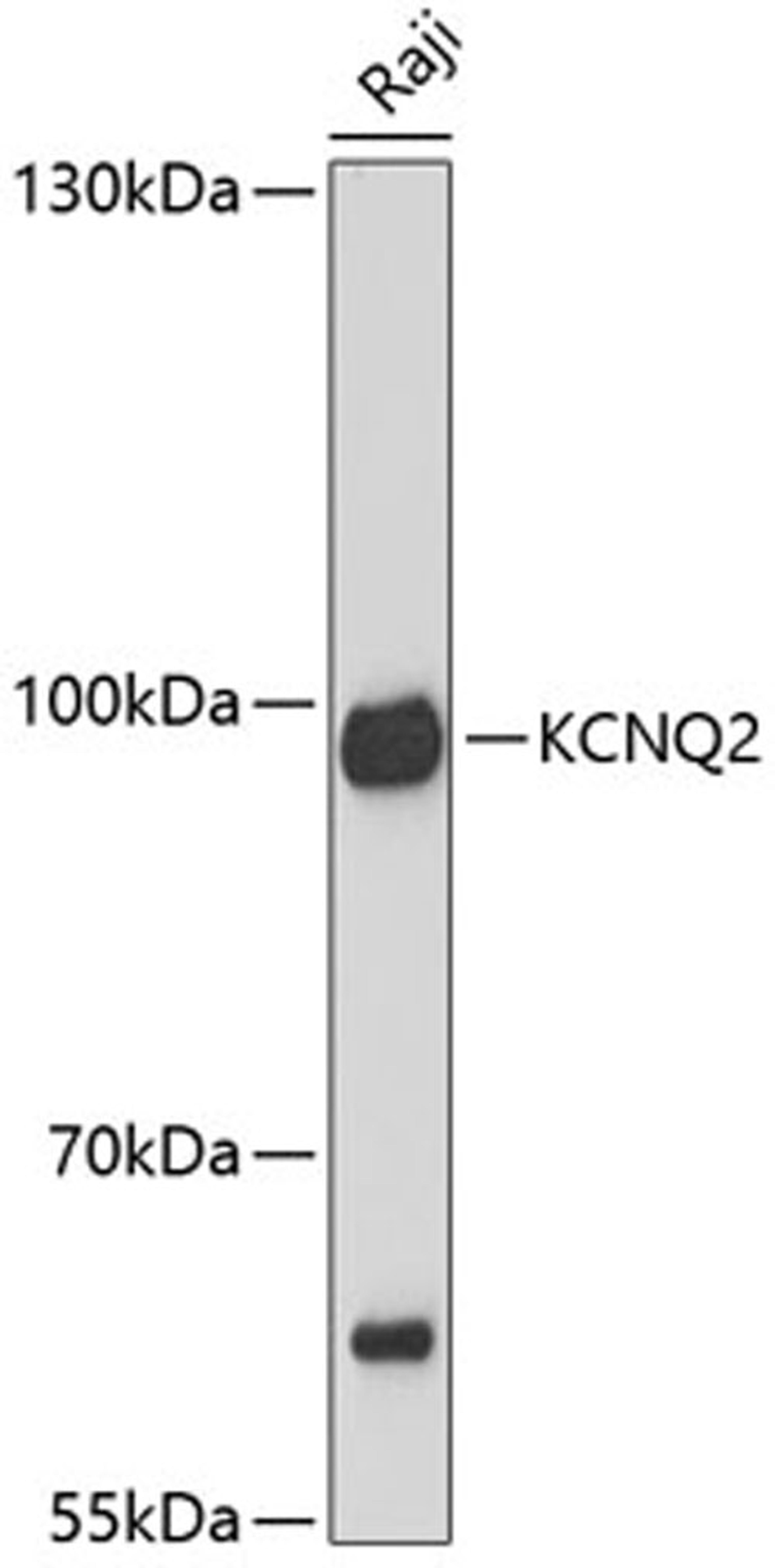 Western blot - KCNQ2 antibody (A1917)