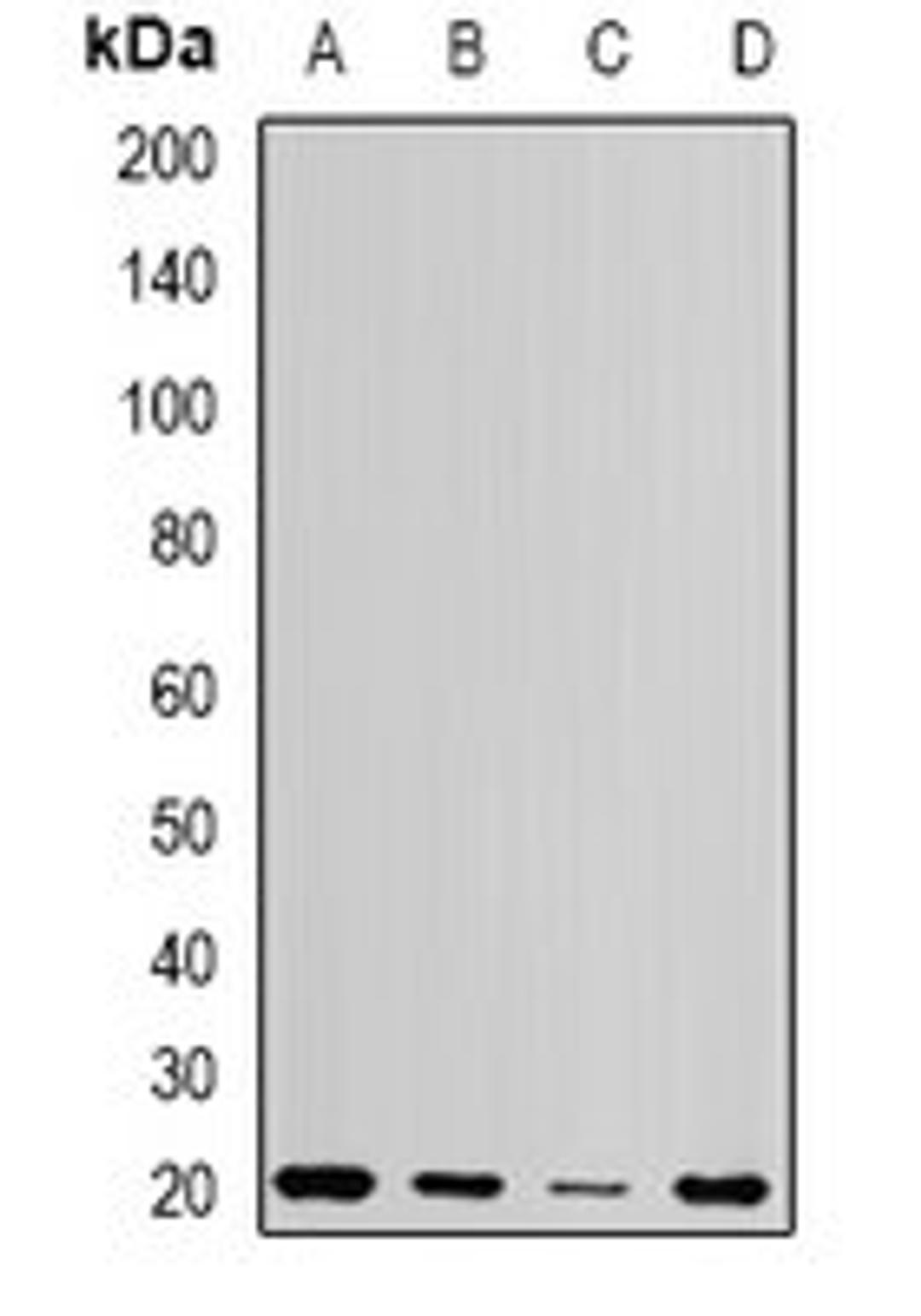 Western blot analysis of Jurkat (Lane1), Hela (Lane2), mouse testis (Lane3), rat testis (Lane4) whole cell lysates using CETN1 antibody