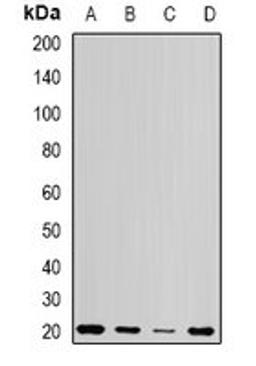 Western blot analysis of Jurkat (Lane1), Hela (Lane2), mouse testis (Lane3), rat testis (Lane4) whole cell lysates using CETN1 antibody