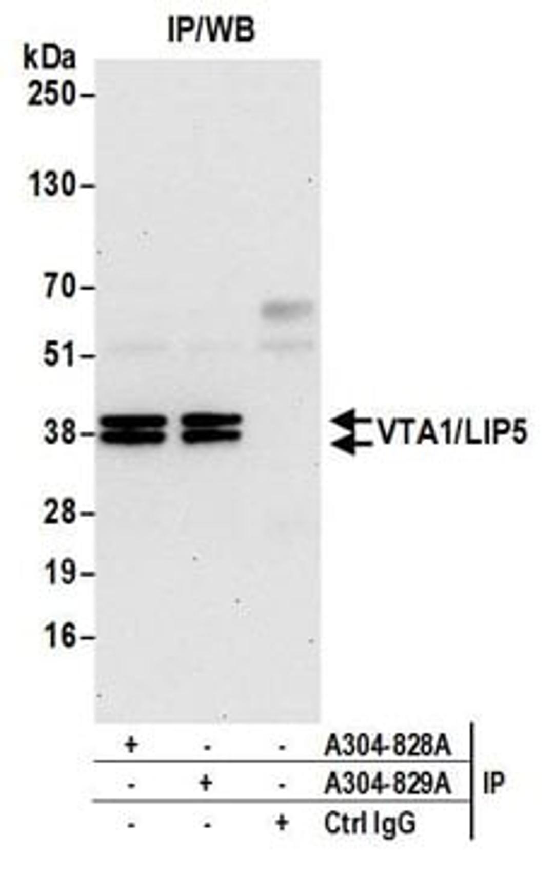 Detection of human VTA1/LIP5 by western blot of immunoprecipitates.