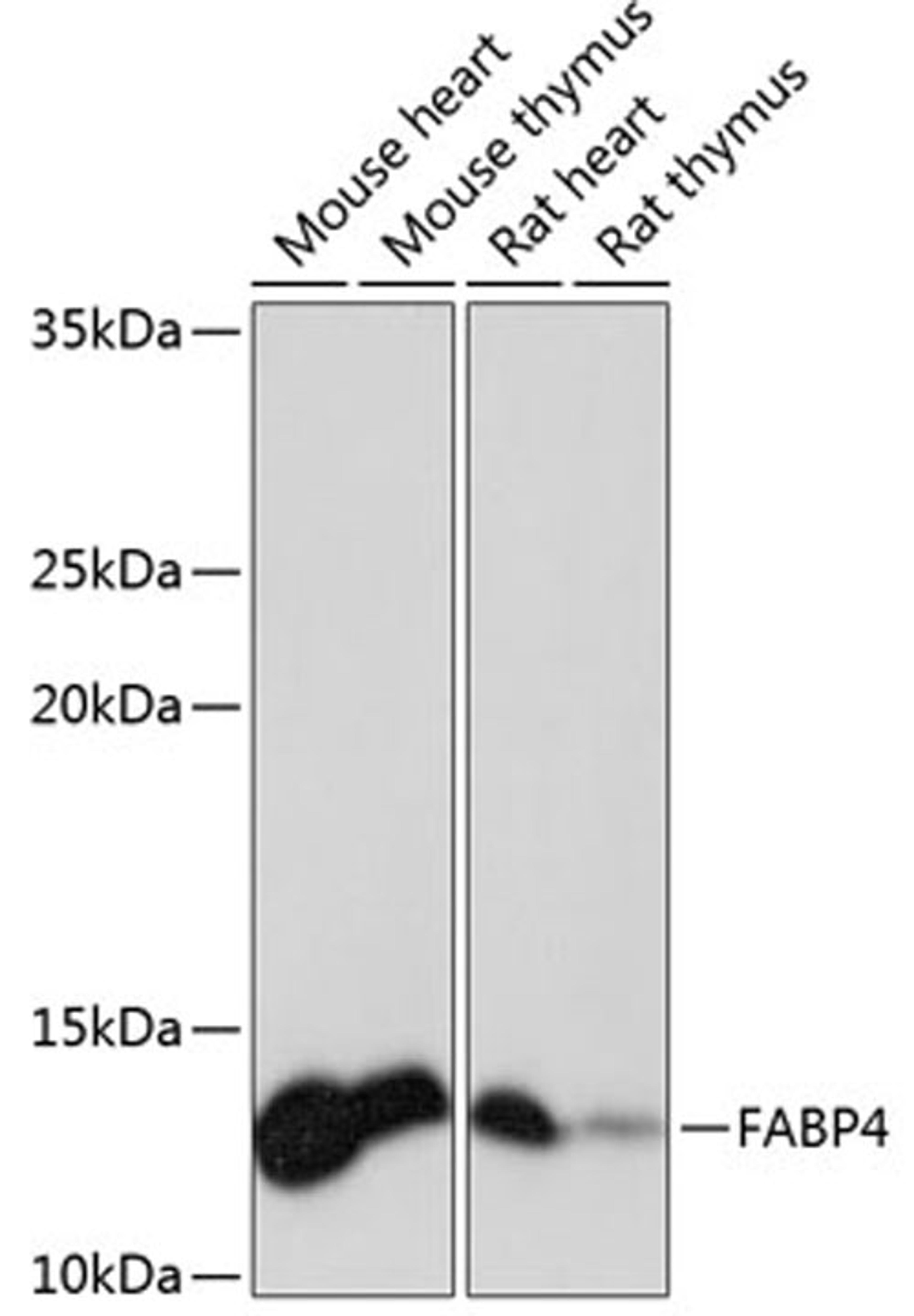 Western blot - FABP4 Rabbit mAb (A11481)