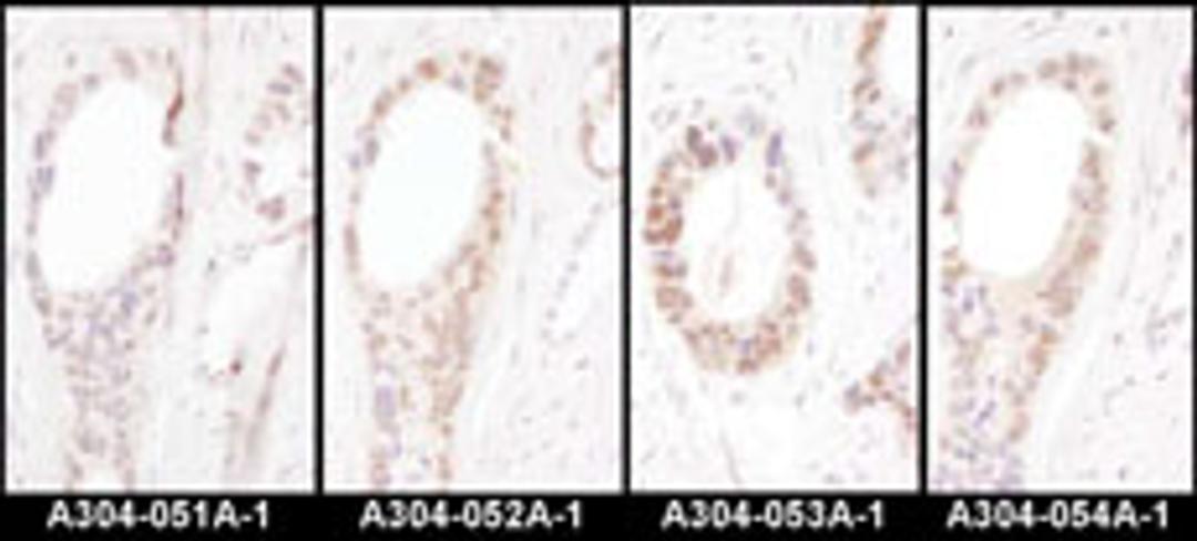 Detection of human HNF1-alpha by immunohistochemistry.