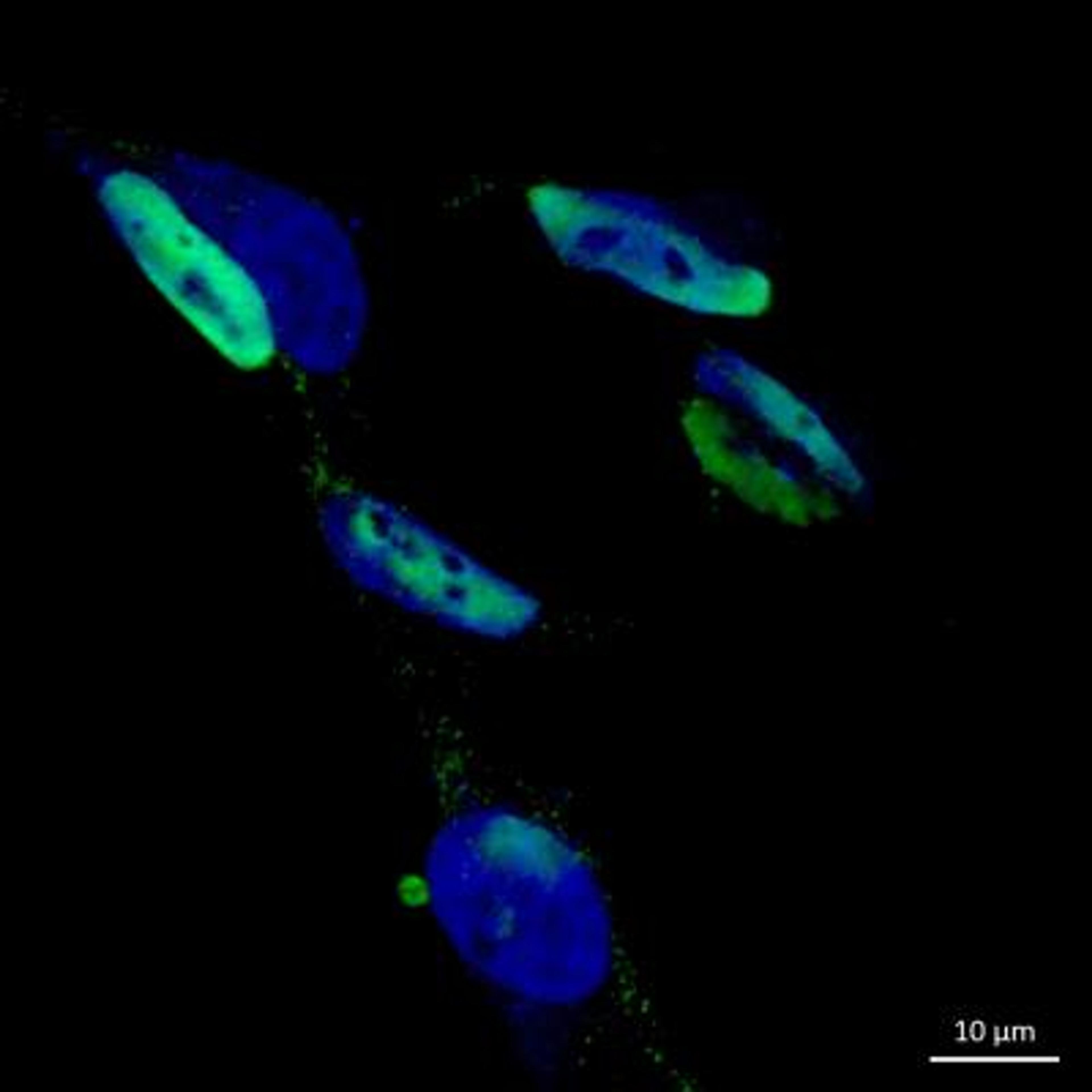 Immunocytochemistry/Immunofluorescence: hnRNP H Antibody [NB100-385] - analysis of hnRNP H in SH-SY5Y cells using anti-hnRNP H antibody (green). Cells were fixed in 4% PFA in PBS for 15 min at room temperature. Image from verified customer review.