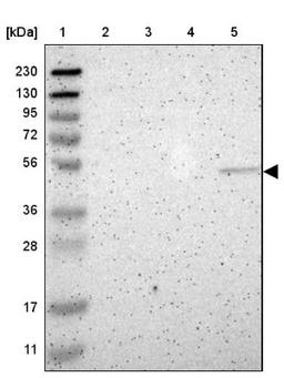 Western Blot: IL5RA Antibody [NBP1-86548] - Lane 1: Marker [kDa] 230, 130, 95, 72, 56, 36, 28, 17, 11<br/>Lane 2: Human cell line RT-4<br/>Lane 3: Human cell line U-251MG sp<br/>Lane 4: Human plasma (IgG/HSA depleted)<br/>Lane 5: Human liver tissue