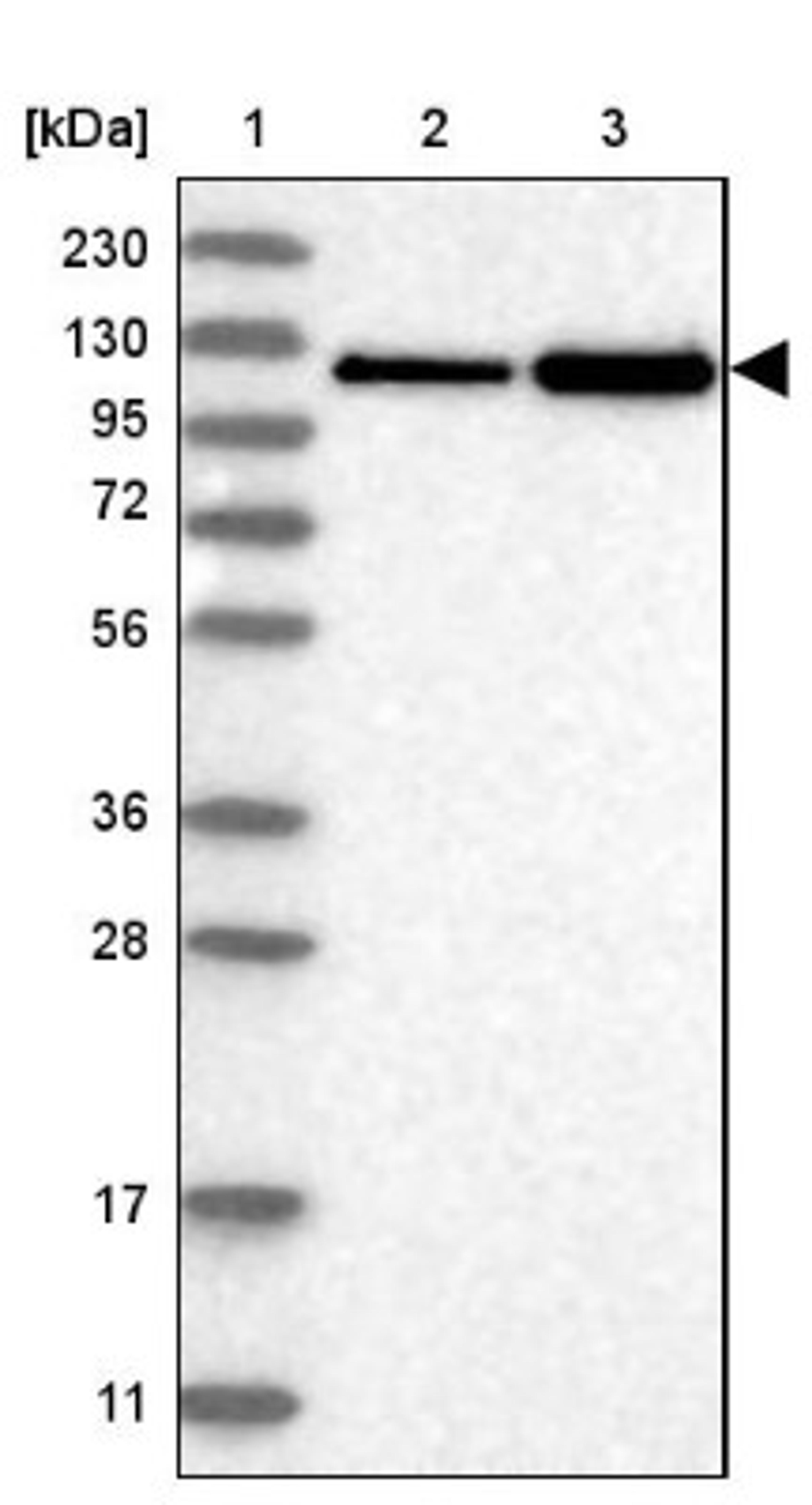 Western Blot: Neogenin Antibody [NBP1-89651] - Lane 1: Marker [kDa] 230, 130, 95, 72, 56, 36, 28, 17, 11<br/>Lane 2: Human cell line RT-4<br/>Lane 3: Human cell line U-251MG sp