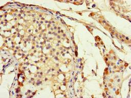 Immunohistochemistry of paraffin-embedded human testis tissue using CSB-PA006956LA01HU at dilution of 1:100