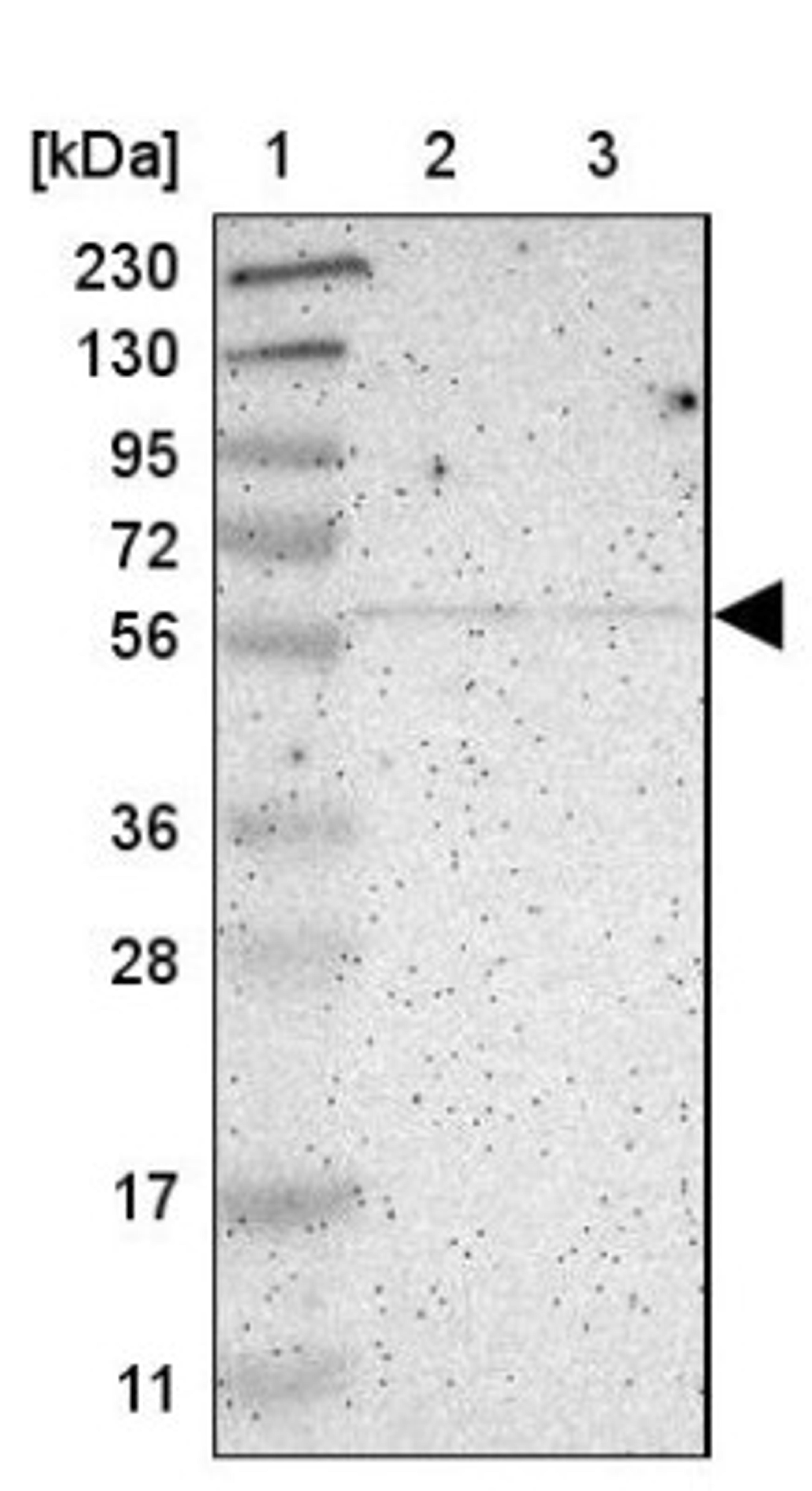 Western Blot: Activin Receptor Type 1C Antibody [NBP1-90252] - Lane 1: Marker [kDa] 230, 130, 95, 72, 56, 36, 28, 17, 11<br/>Lane 2: Human cell line RT-4<br/>Lane 3: Human cell line U-251MG sp