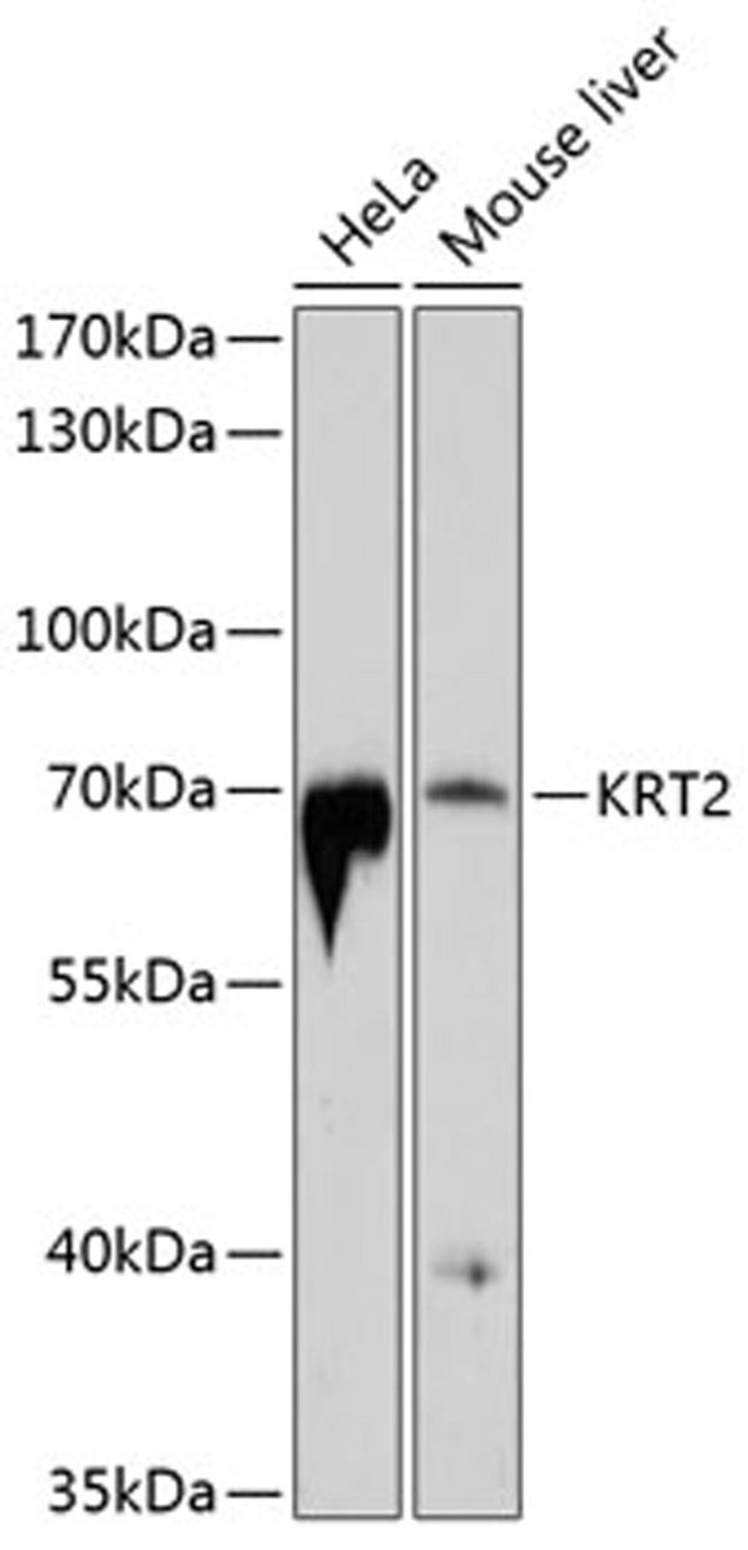 Western blot - KRT2 antibody (A10375)