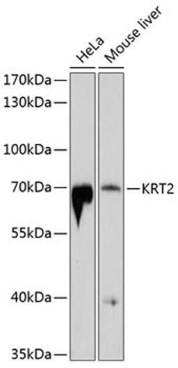 Western blot - KRT2 antibody (A10375)