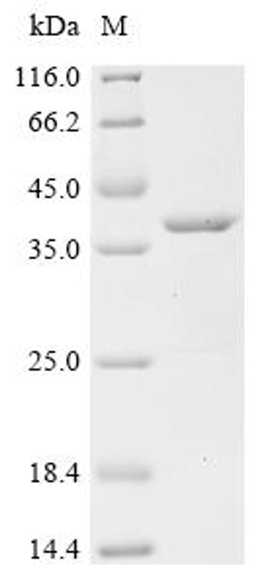 (Tris-Glycine gel) Discontinuous SDS-PAGE (reduced) with 5% enrichment gel and 15% separation gel.