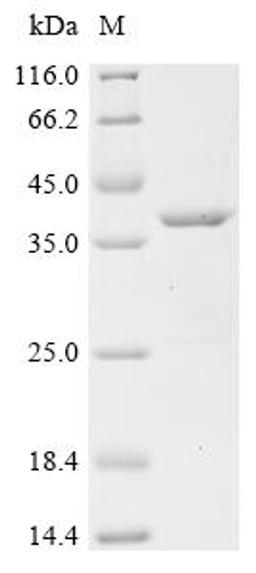 (Tris-Glycine gel) Discontinuous SDS-PAGE (reduced) with 5% enrichment gel and 15% separation gel.
