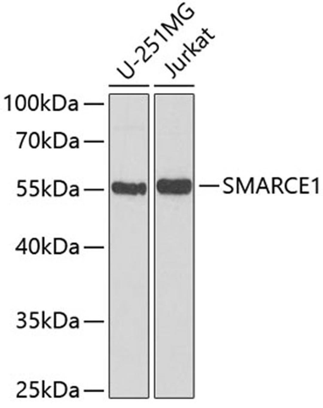 Western blot - SMARCE1 antibody (A5361)