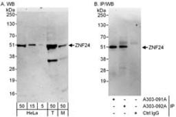 Detection of human and mouse ZNF24 by western blot (h & m) and immunoprecipitation (h).