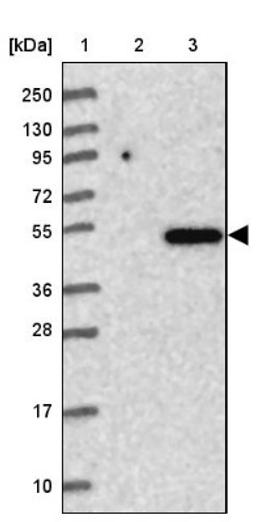 Western Blot: TMEM39A Antibody [NBP1-83813] - Lane 1: Marker [kDa] 250, 130, 95, 72, 55, 36, 28, 17, 10<br/>Lane 2: Human cell line RT-4<br/>Lane 3: Human cell line U-251MG sp