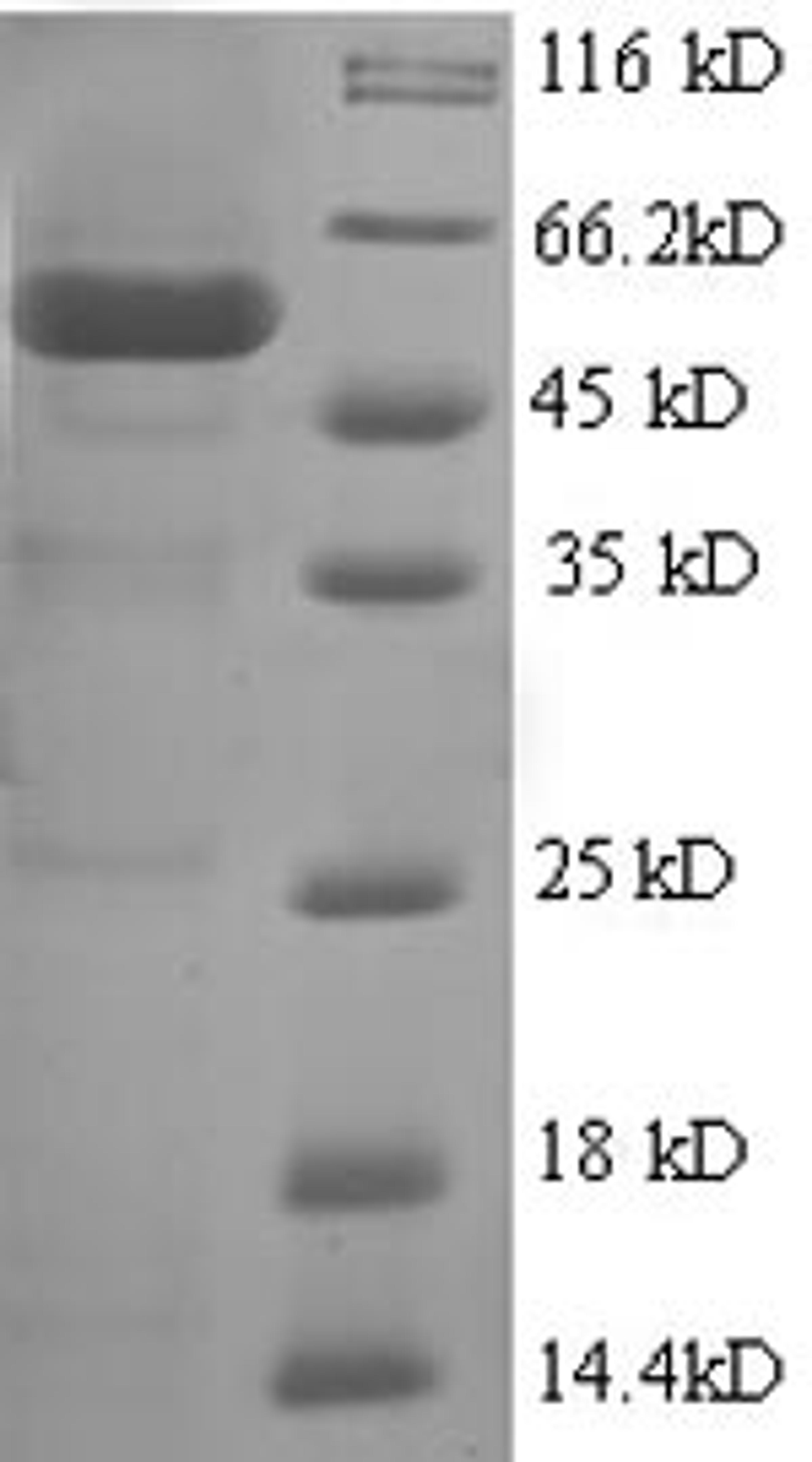 (Tris-Glycine gel) Discontinuous SDS-PAGE (reduced) with 5% enrichment gel and 15% separation gel.