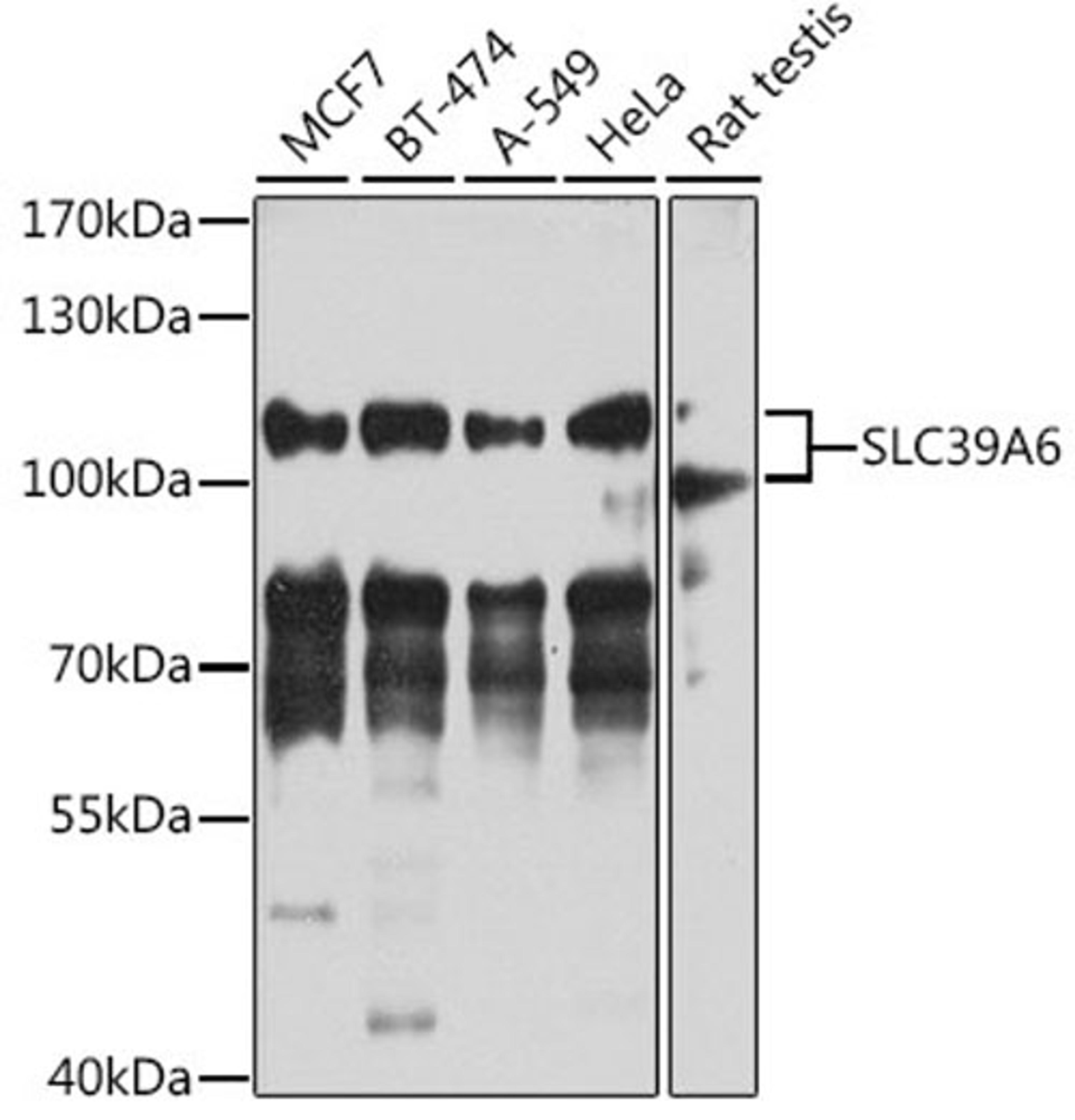 Western blot - SLC39A6 antibody (A4584)