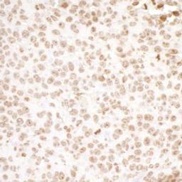 Detection of mouse H2AX by immunohistochemistry.