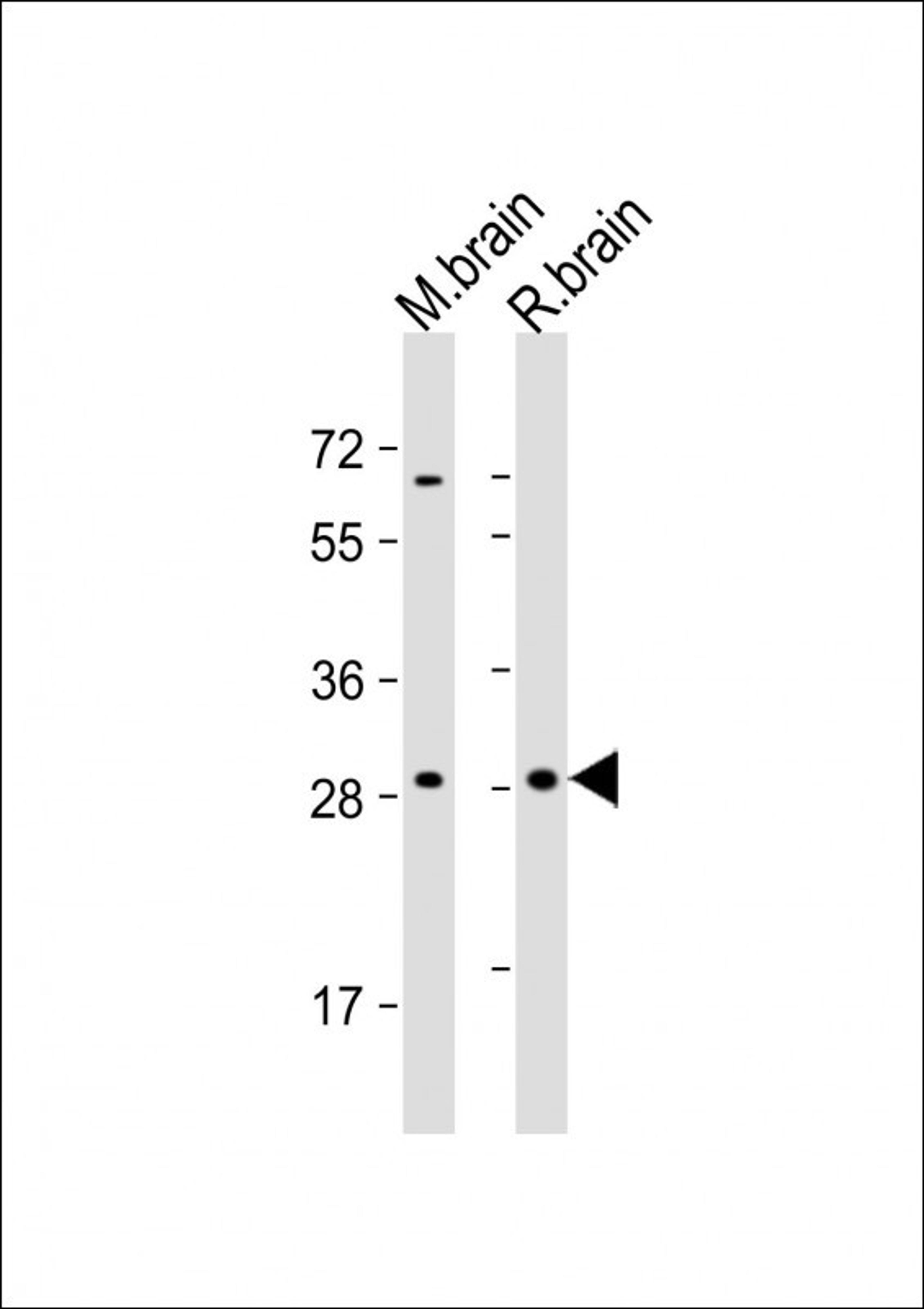 Western Blot at 1:2000 dilution Lane 1: mouse brain lysate Lane 2: rat brain lysate Lysates/proteins at 20 ug per lane.