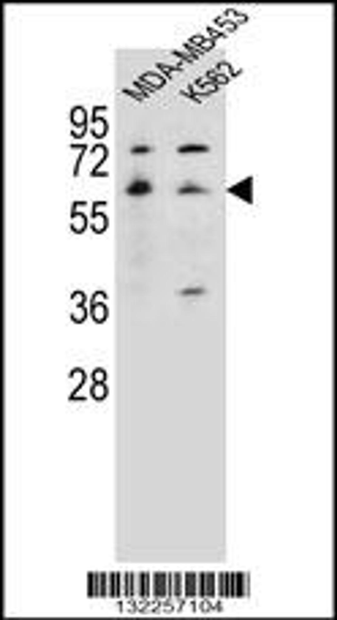 Western blot analysis in MDA-MB453,K562 cell line lysates (35ug/lane).