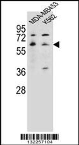 Western blot analysis in MDA-MB453,K562 cell line lysates (35ug/lane).