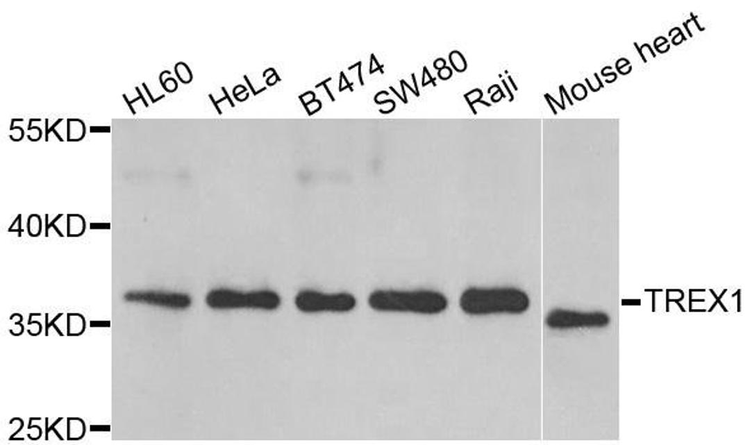 Western blot analysis of extracts of various cell lines using TREX1 antibody