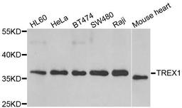 Western blot analysis of extracts of various cell lines using TREX1 antibody