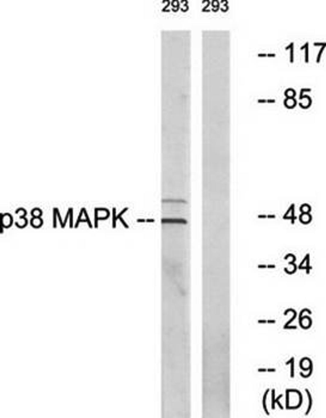 Western blot analysis of extracts from 293 cells using p38 MAPK antibody