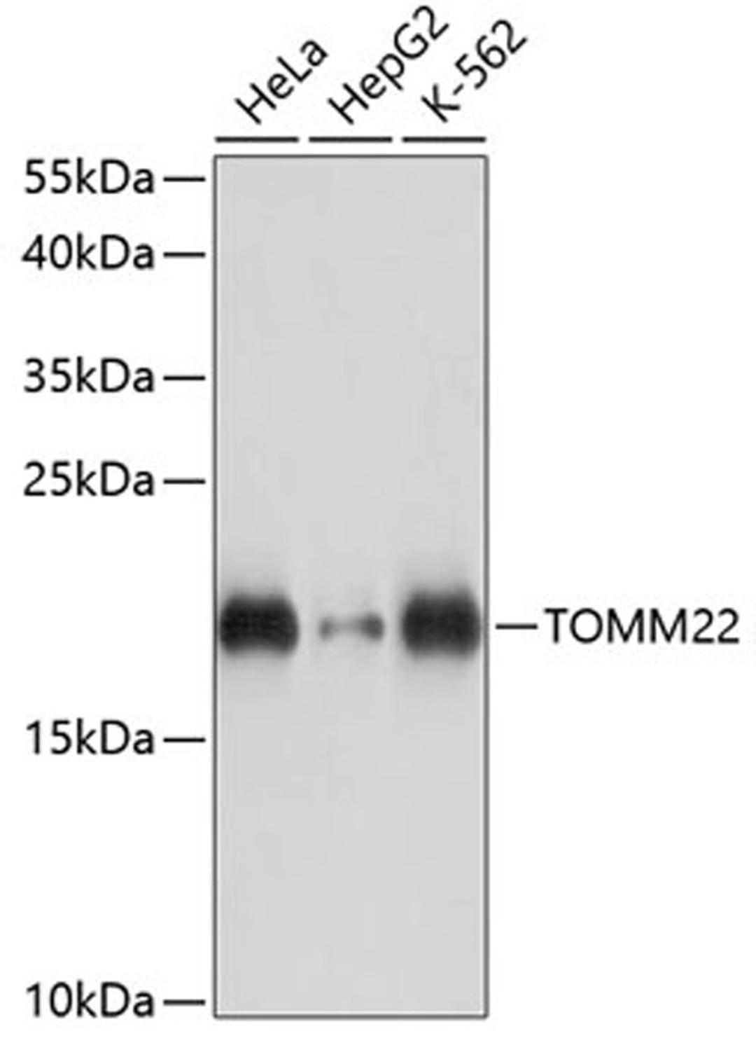 Western blot - TOMM22 antibody (A14548)