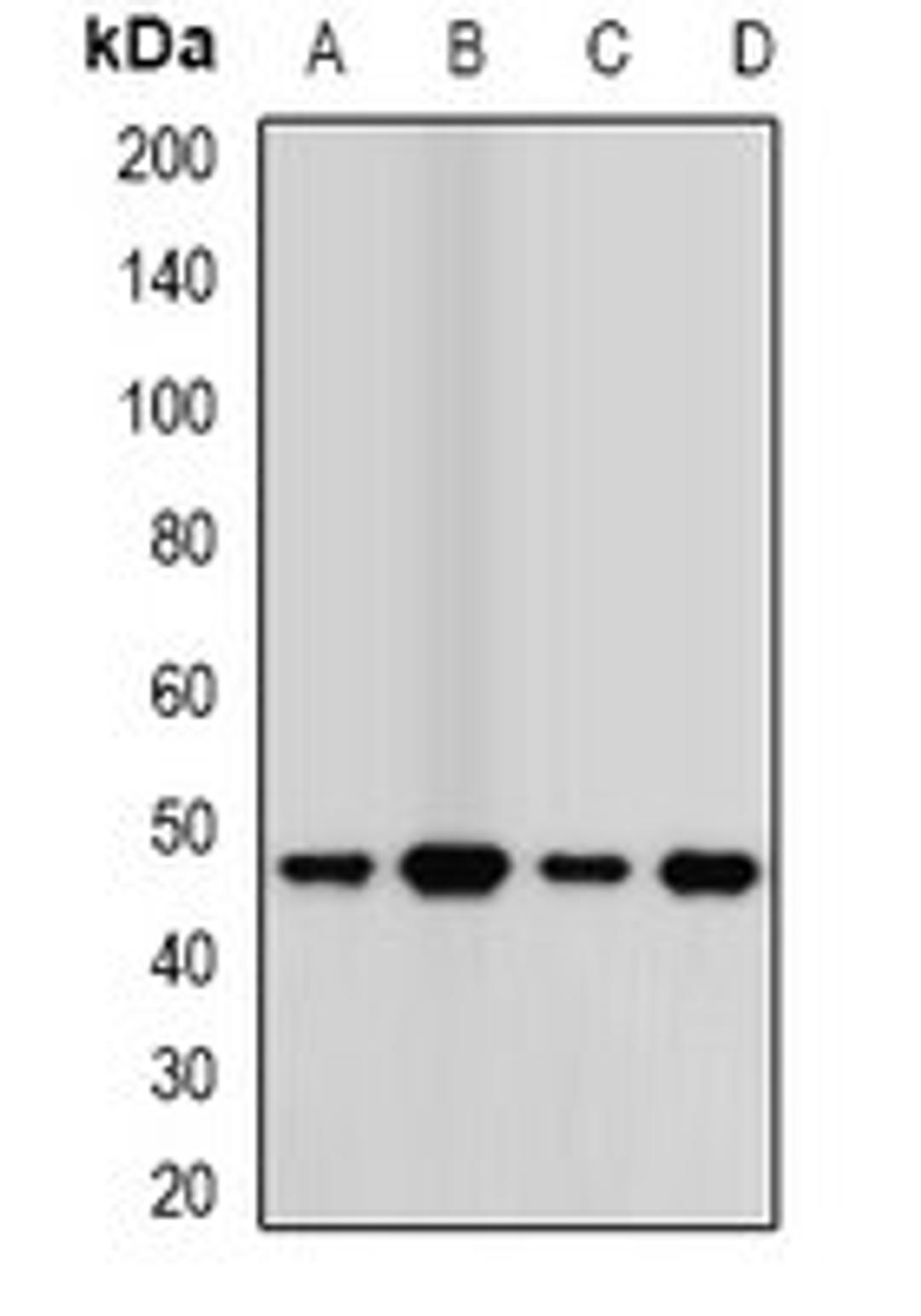 Western blot analysis of MCF7 (Lane1), A549 (Lane2), mouse kidney (Lane3), mouse lung (Lane4) whole cell lysates using TCN2 antibody