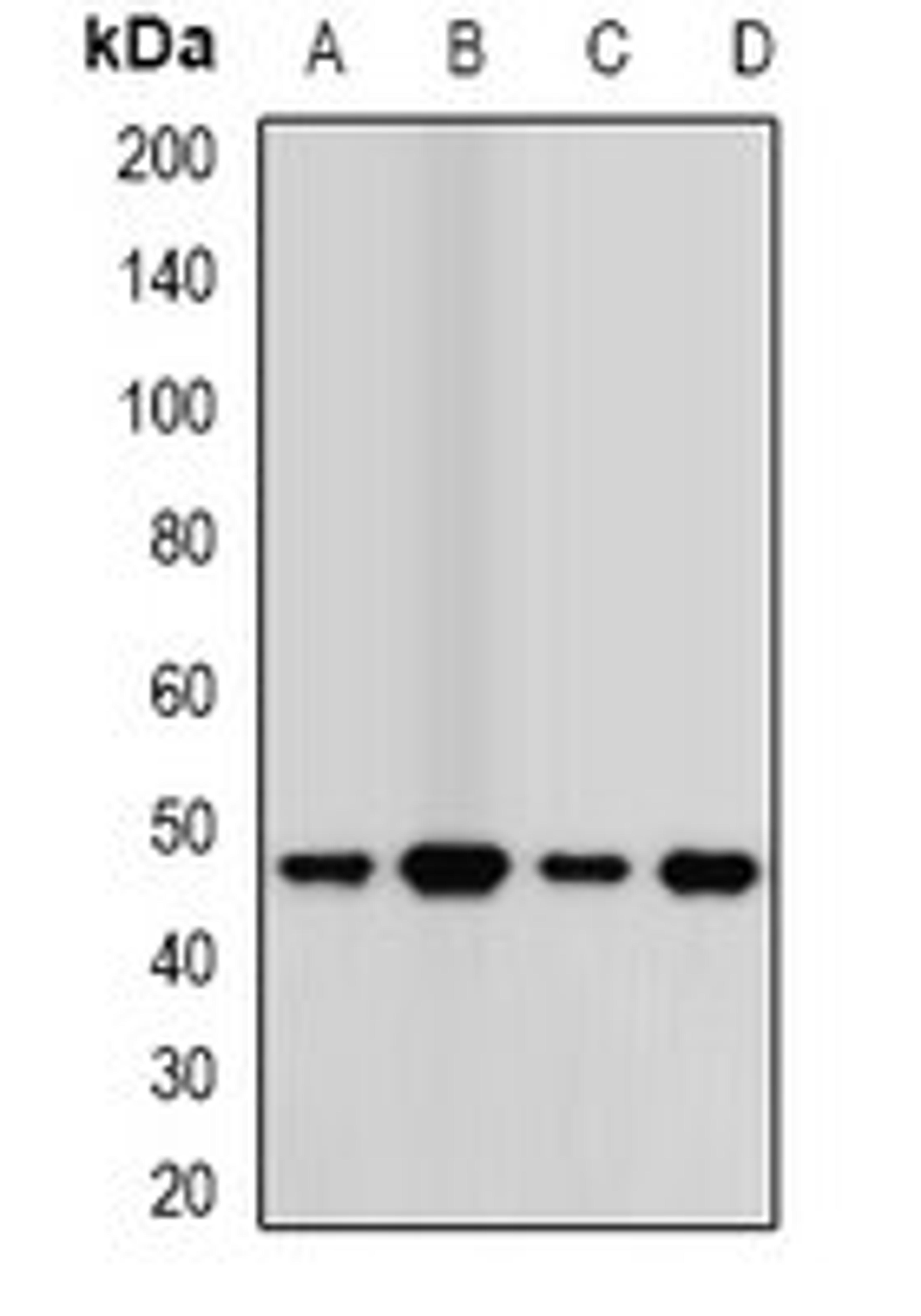 Western blot analysis of MCF7 (Lane1), A549 (Lane2), mouse kidney (Lane3), mouse lung (Lane4) whole cell lysates using TCN2 antibody