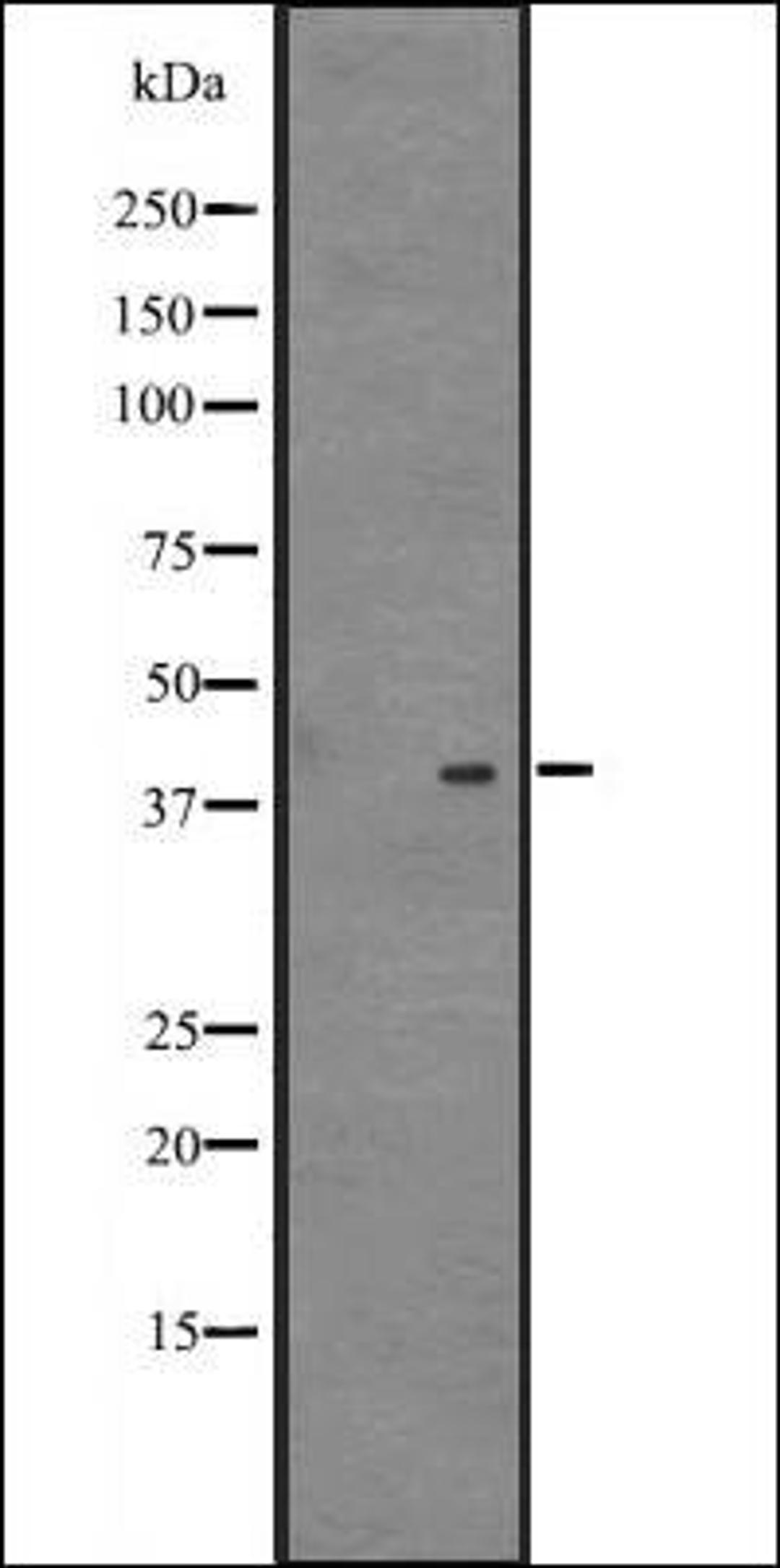 Western blot analysis of 721_B cell lysate using NDFIP2 antibody