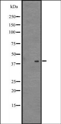 Western blot analysis of 721_B cell lysate using NDFIP2 antibody