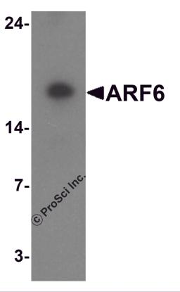 Western blot analysis of ARF6 in rat liver tissue lysate with ARF6 antibody at 1 &#956;g/ml.