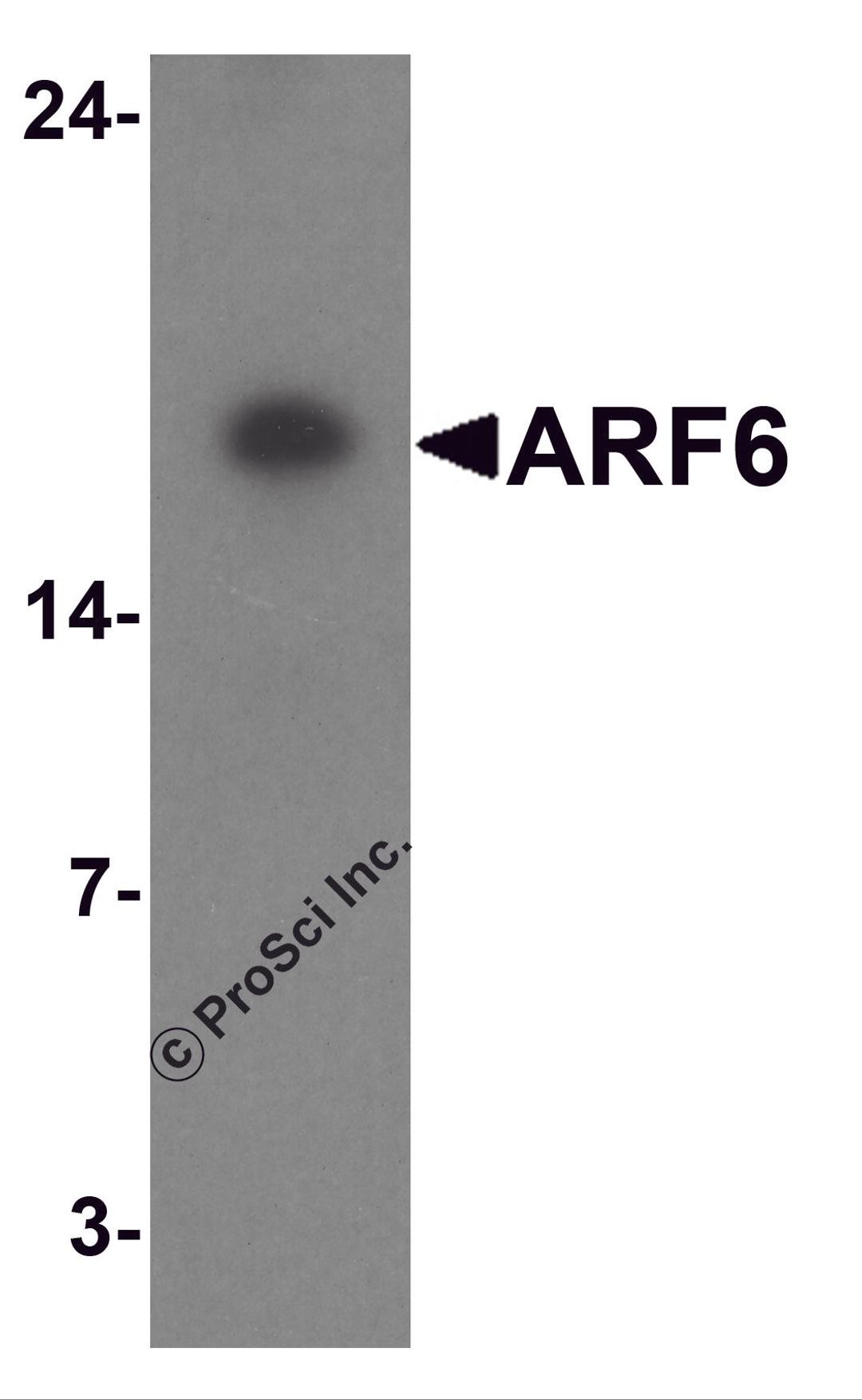 Western blot analysis of ARF6 in rat liver tissue lysate with ARF6 antibody at 1 μg/ml.