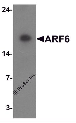 Western blot analysis of ARF6 in rat liver tissue lysate with ARF6 antibody at 1 μg/ml.