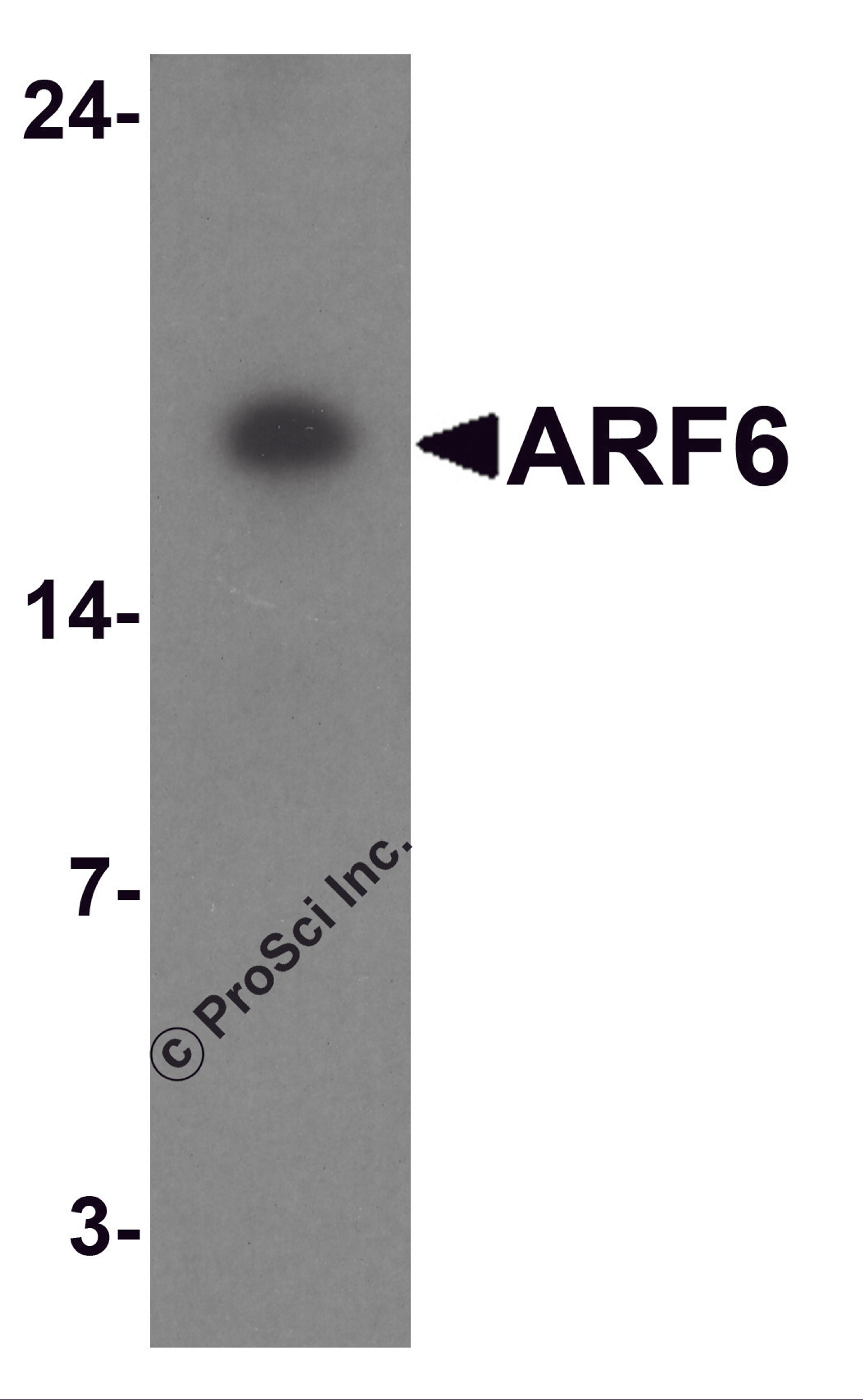 Western blot analysis of ARF6 in rat liver tissue lysate with ARF6 antibody at 1 μg/ml.