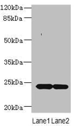 Western blot. All lanes: MRAP2 antibody at 7µg/ml. Lane 1: Mouse brain tissue. Lane 2: Mouse kidney tissue. Secondary. Goat polyclonal to rabbit IgG at 1/10000 dilution. Predicted band size: 24 kDa. Observed band size: 24 kDa