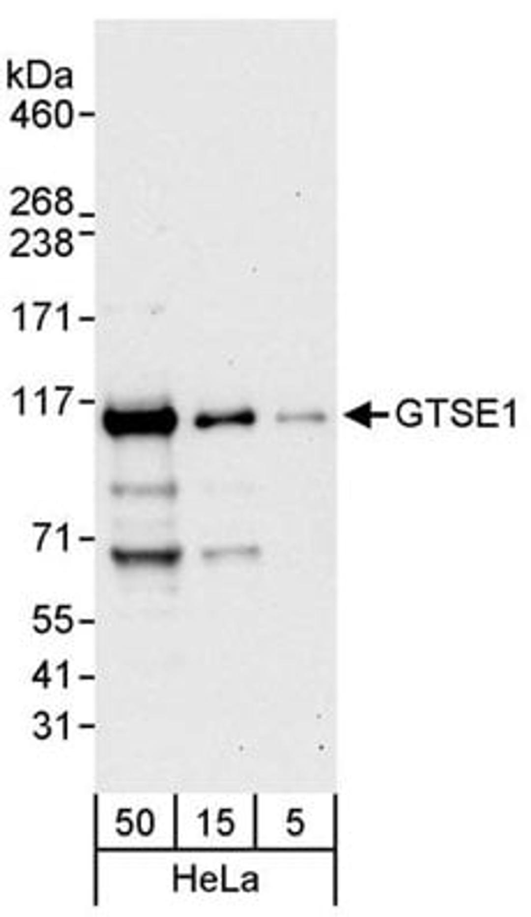 Detection of human GTSE1 by western blot.