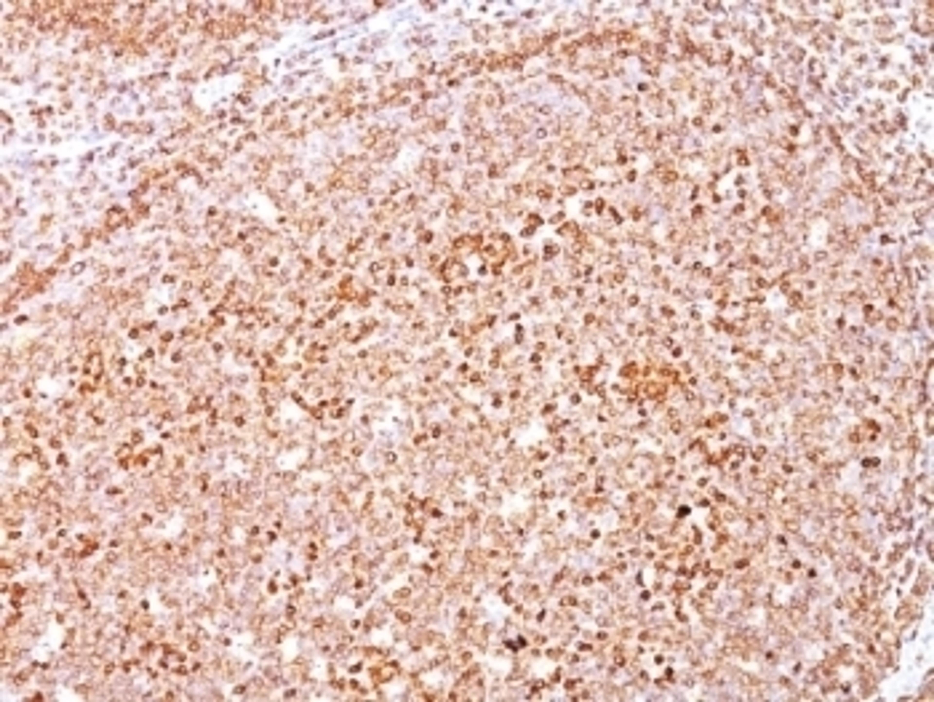 Formalin-fixed, paraffin-embedded human tonsil stained with anti-CD79a antibody (SPM550).