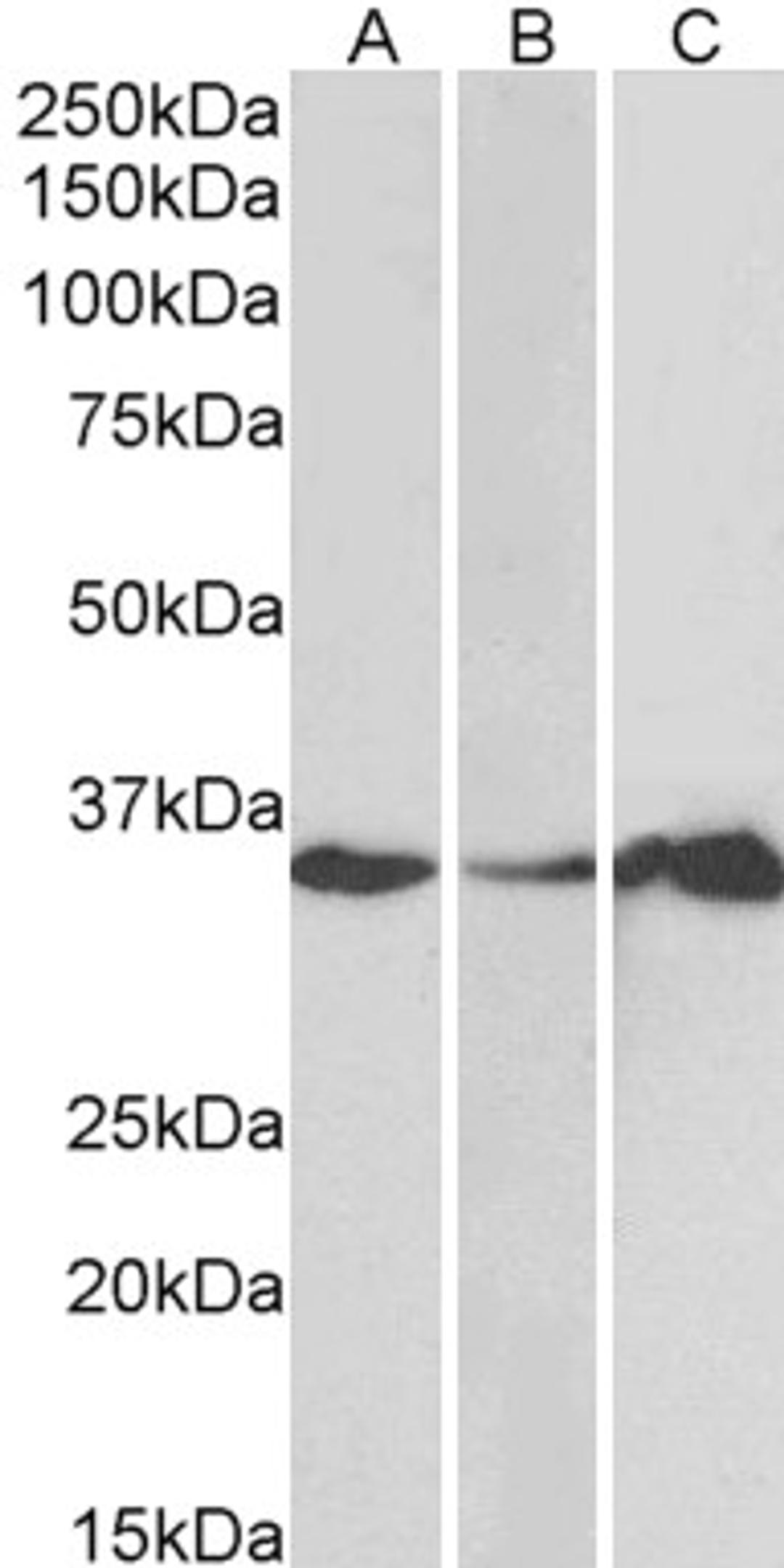 45-822 (1ug/ml) staining of Human Cerebellum (A), Colon (B) and Duodenum (C) lysate (35ug protein in RIPA buffer). Primary incubation was 1 hour. Detected by chemiluminescence