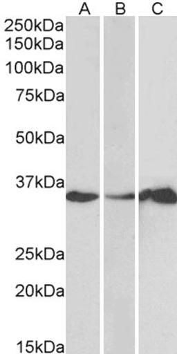 45-822 (1ug/ml) staining of Human Cerebellum (A), Colon (B) and Duodenum (C) lysate (35ug protein in RIPA buffer). Primary incubation was 1 hour. Detected by chemiluminescence