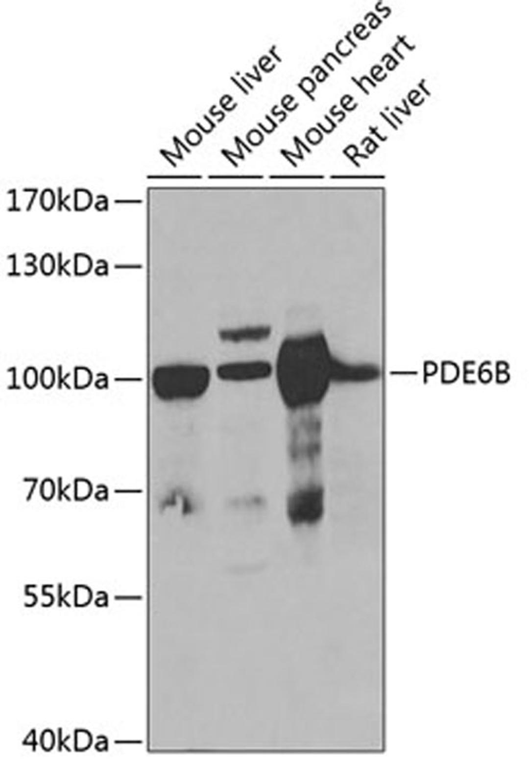 Western blot - PDE6B antibody (A6942)