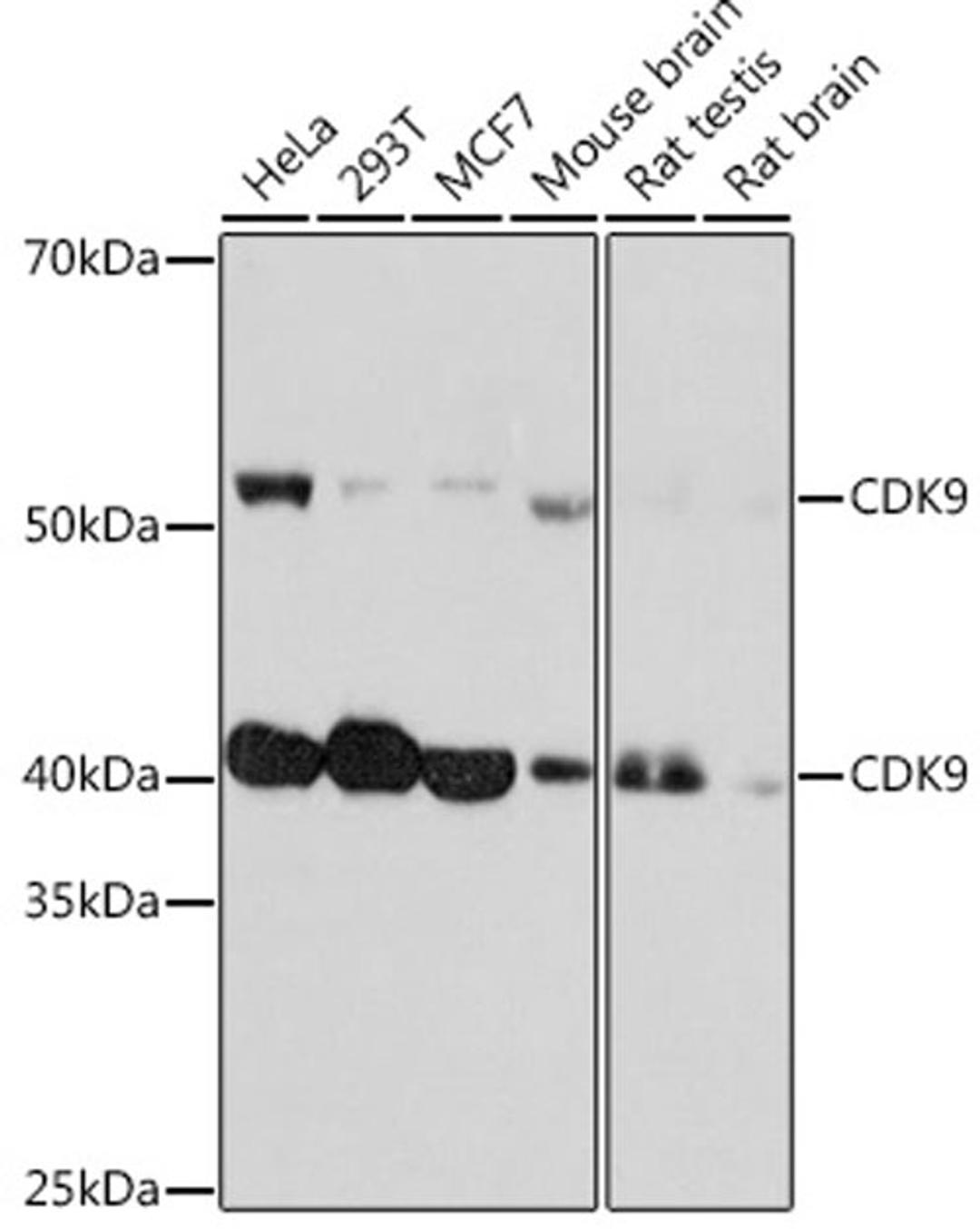 Western blot - CDK9 Rabbit mAb (A11145)