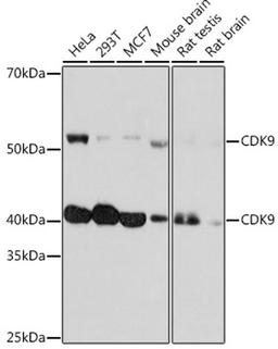 Western blot - CDK9 Rabbit mAb (A11145)