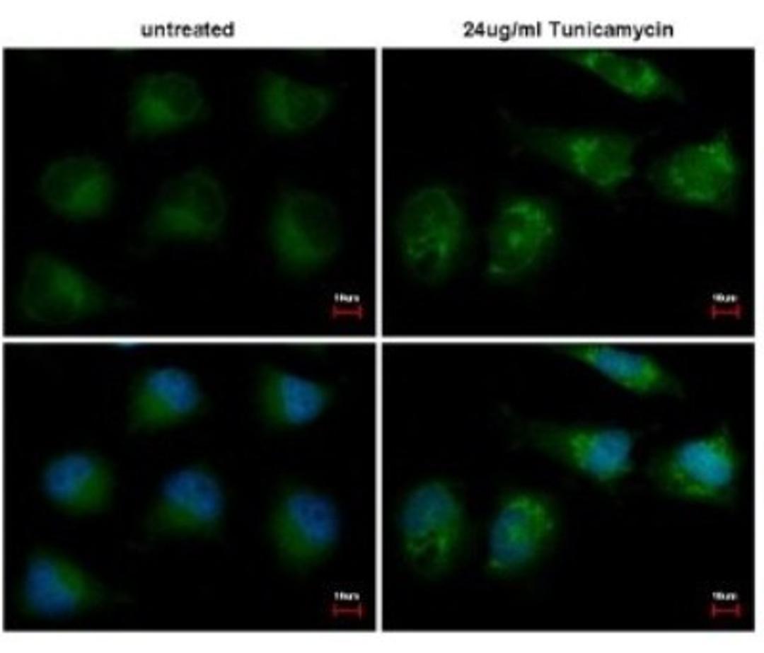 Immunocytochemistry/Immunofluorescence: ATG12 Antibody [NBP2-15501] - ATG12 antibody detects ATG12 protein at cytoplasm by immunofluorescent analysis. Sample: 24ug/ml Tunicamycin treated (right) or untreated (left) HeLa cells were fixed in 4% paraformaldehyde for 15 min. Green: ATG12 protein stained by ATG12 antibody diluted at 1:500. Red: Tubulin, alpha 4a, a cytoskeleton marker, stained by alpha Tubulin antibody [B-5-1-2] diluted at 1:2500. Blue: Hoechst 33342 staining. Scale bar = 10 um.