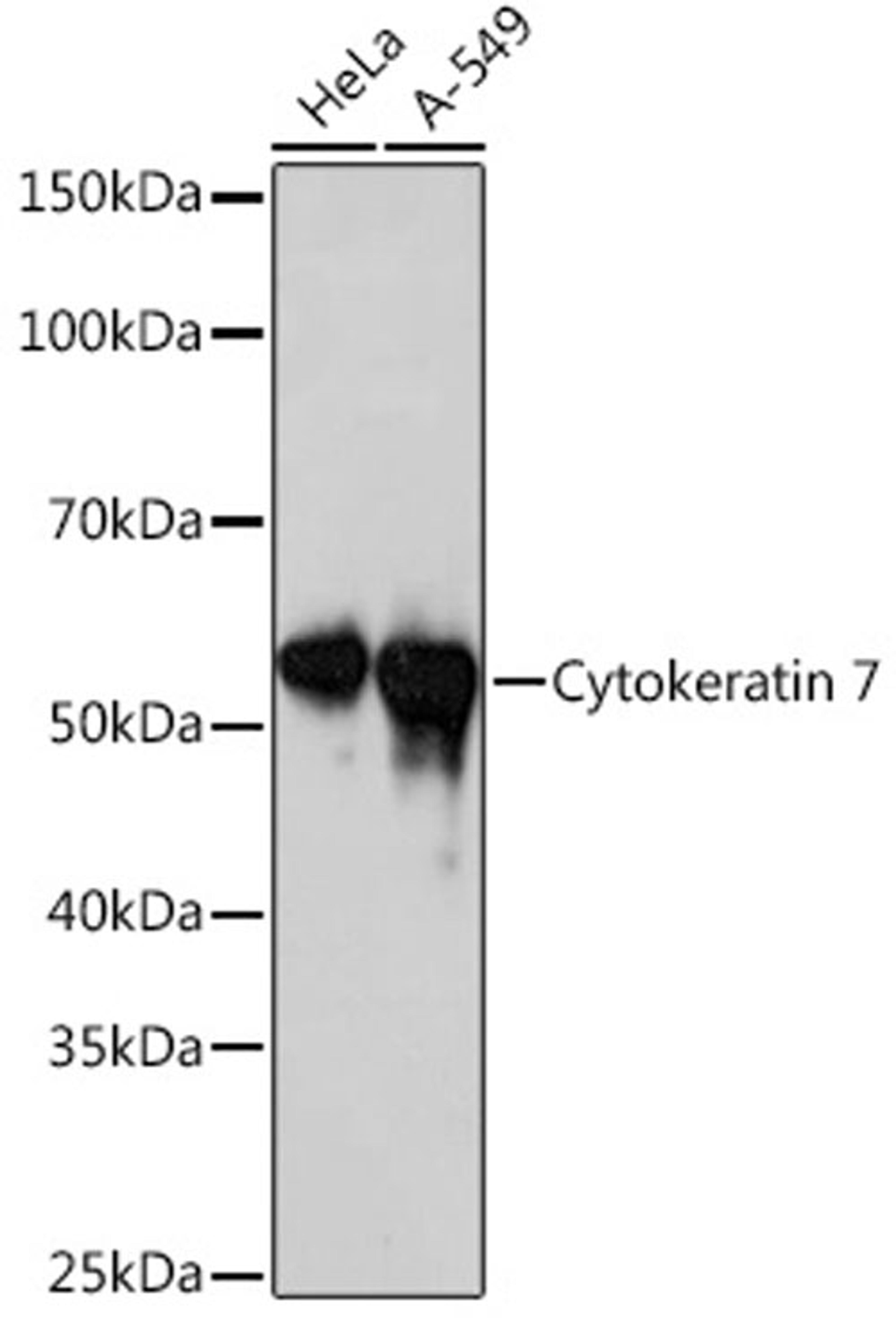 Western blot - Cytokeratin 7   Rabbit mAb (A4765)